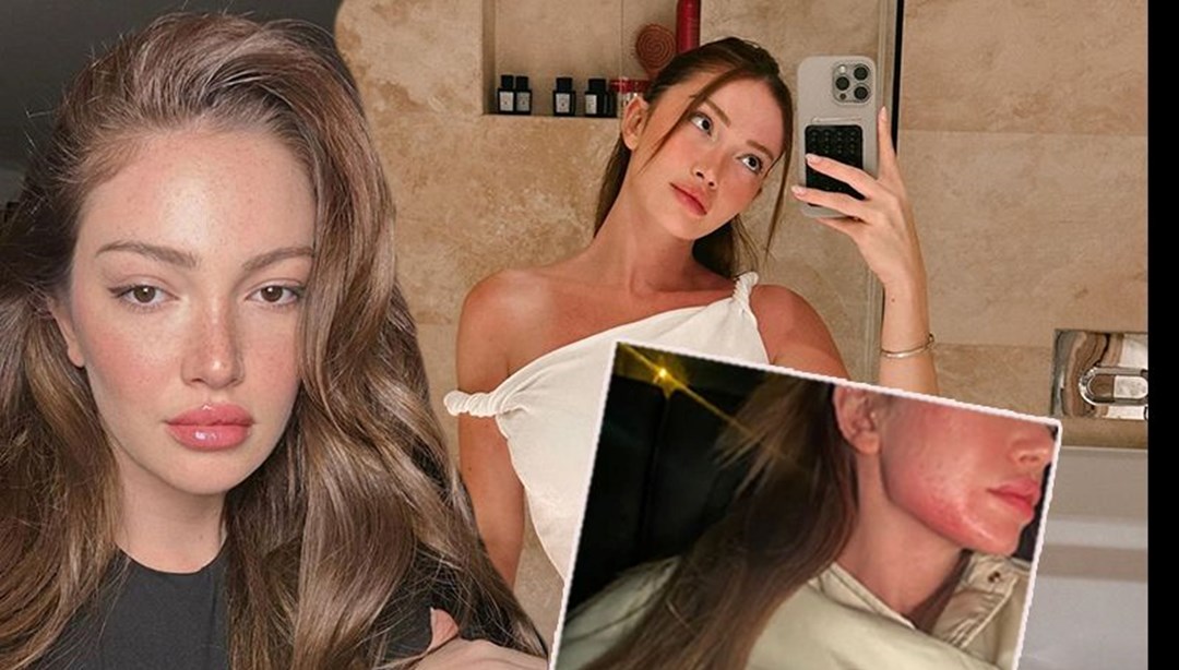 Danla Bilic darp fotoÄrafÄ±nÄ± paylaÅtÄ± | Eski sevgilisi tutuklandÄ±